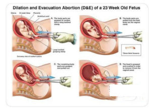 拜登,美国堕胎,美国打胎,罗诉韦德案,胎儿生命权,心跳法案,中期选举2022,堕胎权